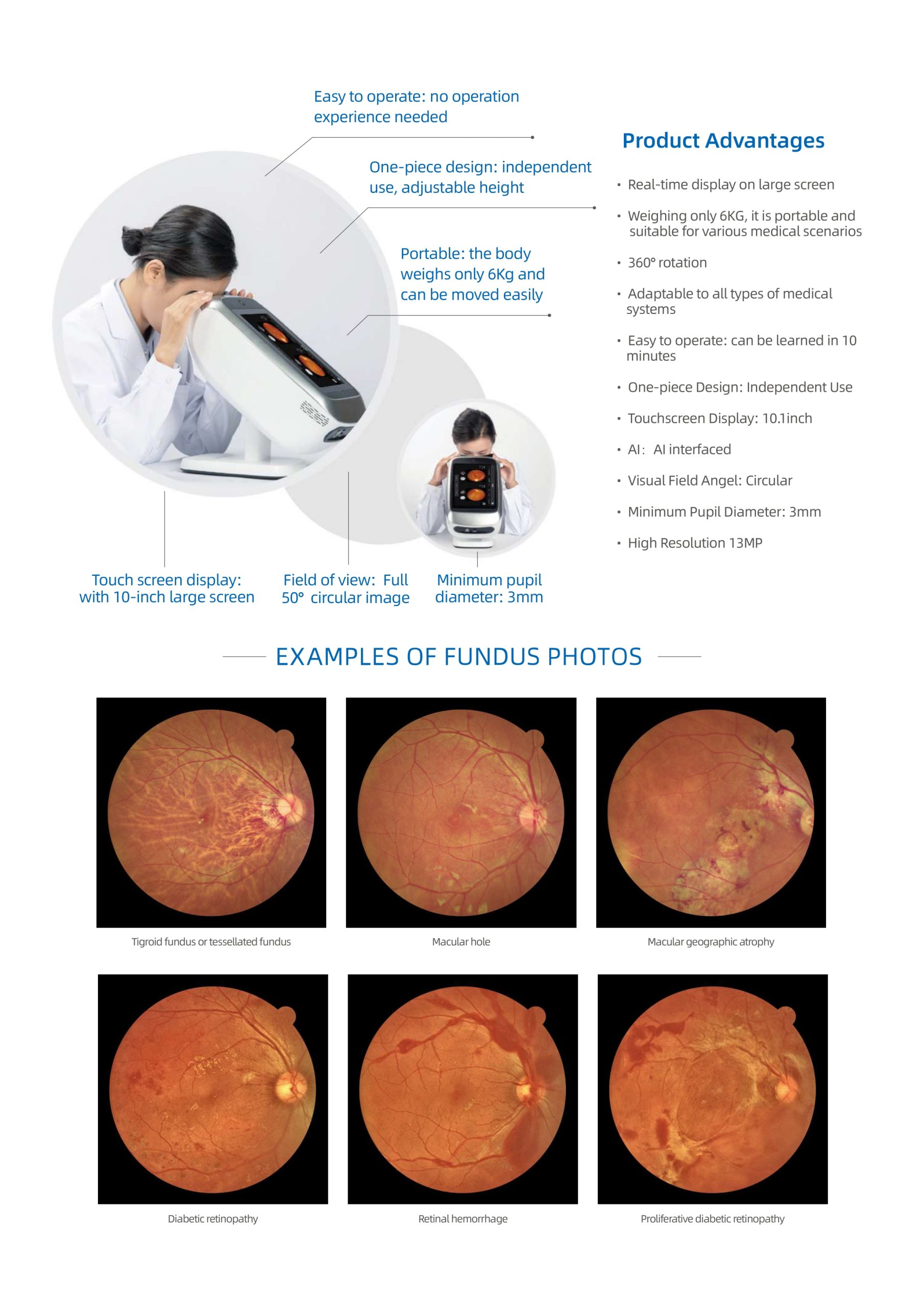 Non mydiatic fundus camera_page-0003